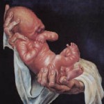 Baby Ursus 1927 1a
